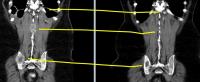 Coronal View.JPG